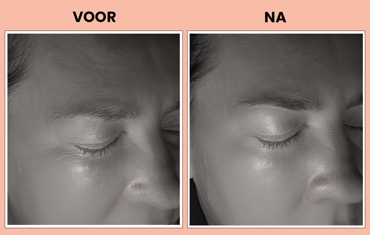 voor- en na SoMe voor- en na SoMe